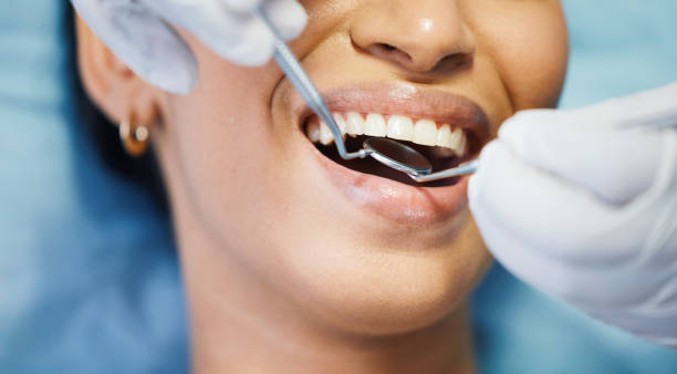 Best Emergency Root Canal Treatment in Mineralwells, WV